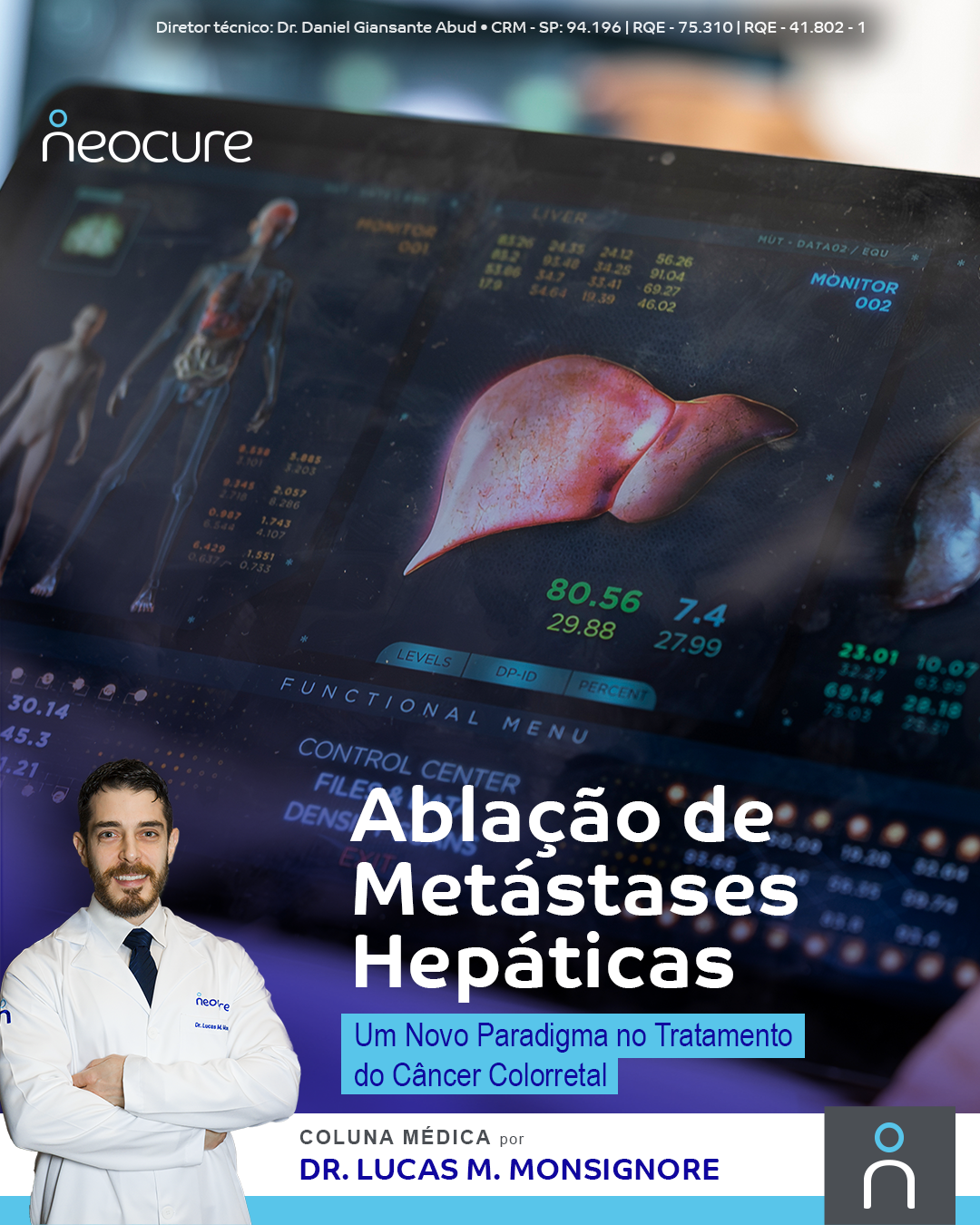 Ablação de Metástases Hepáticas: Um Novo Paradigma no Tratamento do Câncer Colorretal