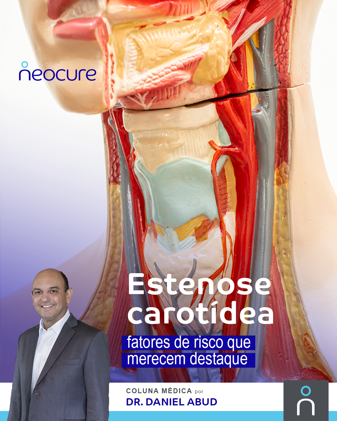 Estenose carotídea: fatores de risco que merecem destaque