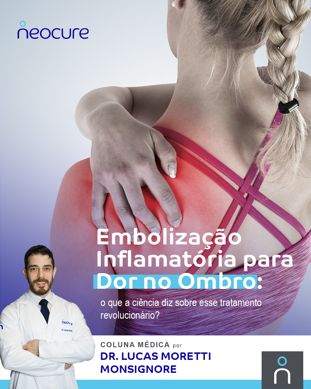 Embolização Inflamatória para Dor no Ombro: O Que a Ciência Diz Sobre Esse Tratamento Revolucionário?