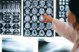 Recharge and Refocus: The Power of Brain Breaks for Youth Learning and Well-Being