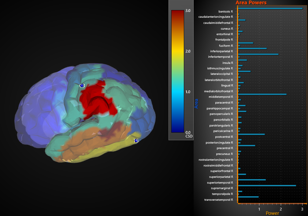 3D Brain imaging data visualization with color-coded regions and a bar graph showing power levels across various brain areas.