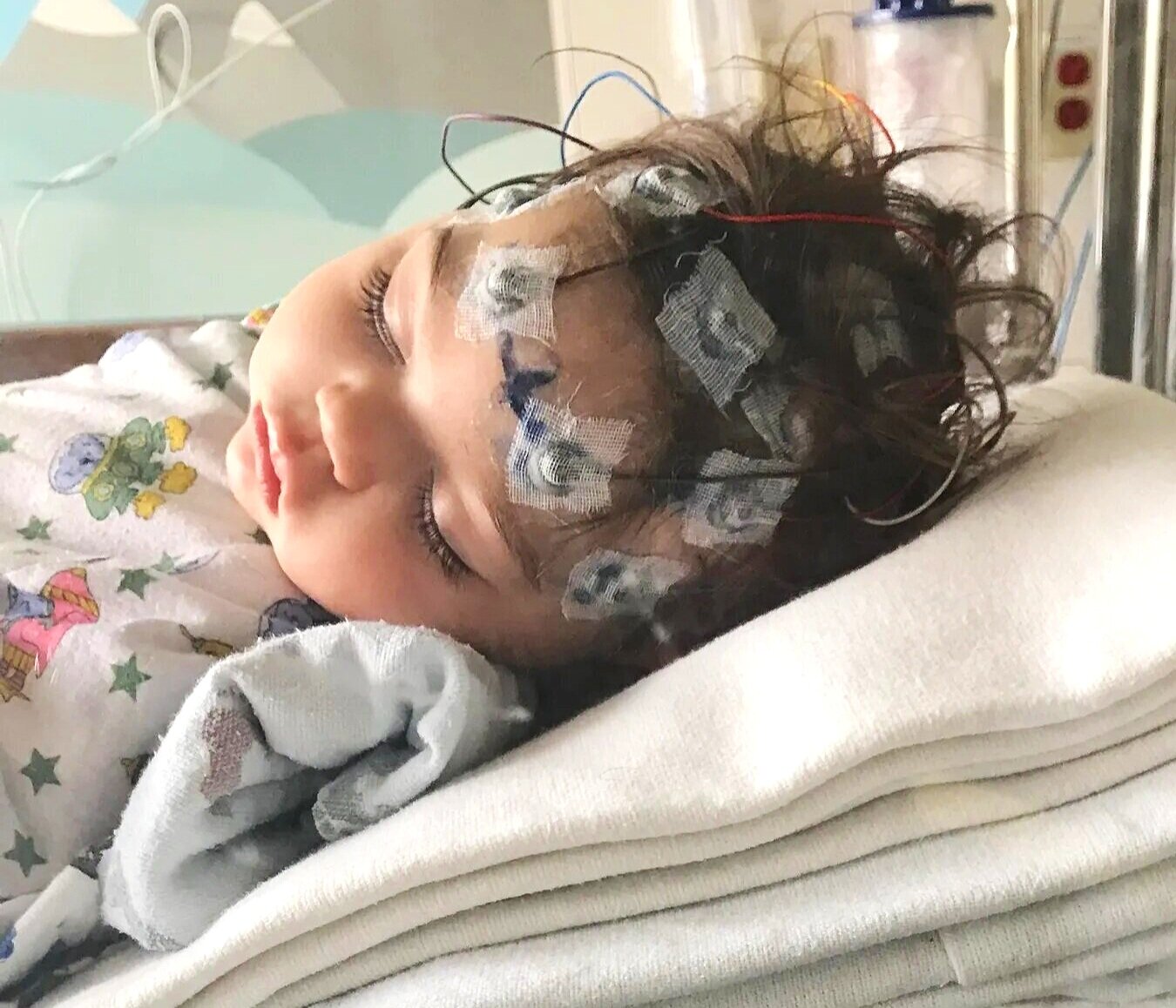 KCNT1 Epilepsy Foundation Hope on the Horizon