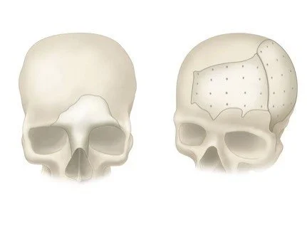 cranial 2.jpg