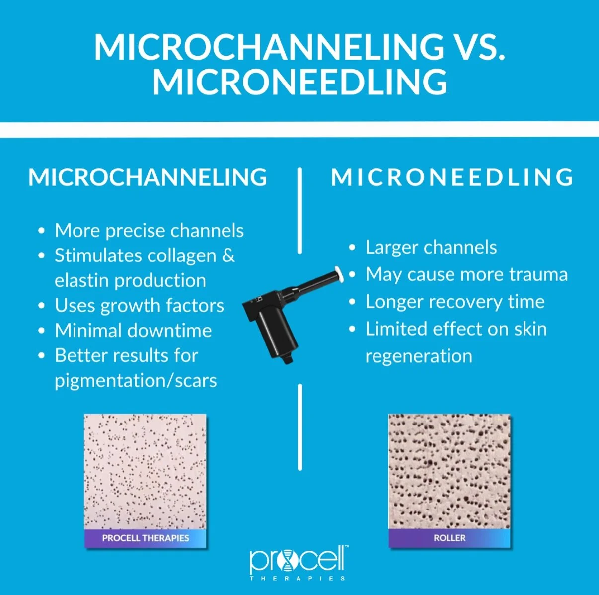 A frequent question we get asked! 💡

Microchanneling &gt; Microneedling 💉✨
Faster healing, less downtime, &amp; boosted results with targeted serums! 🔬💧

Text us today at (440)617-9610 to book your first procell treatment for 50% off in September