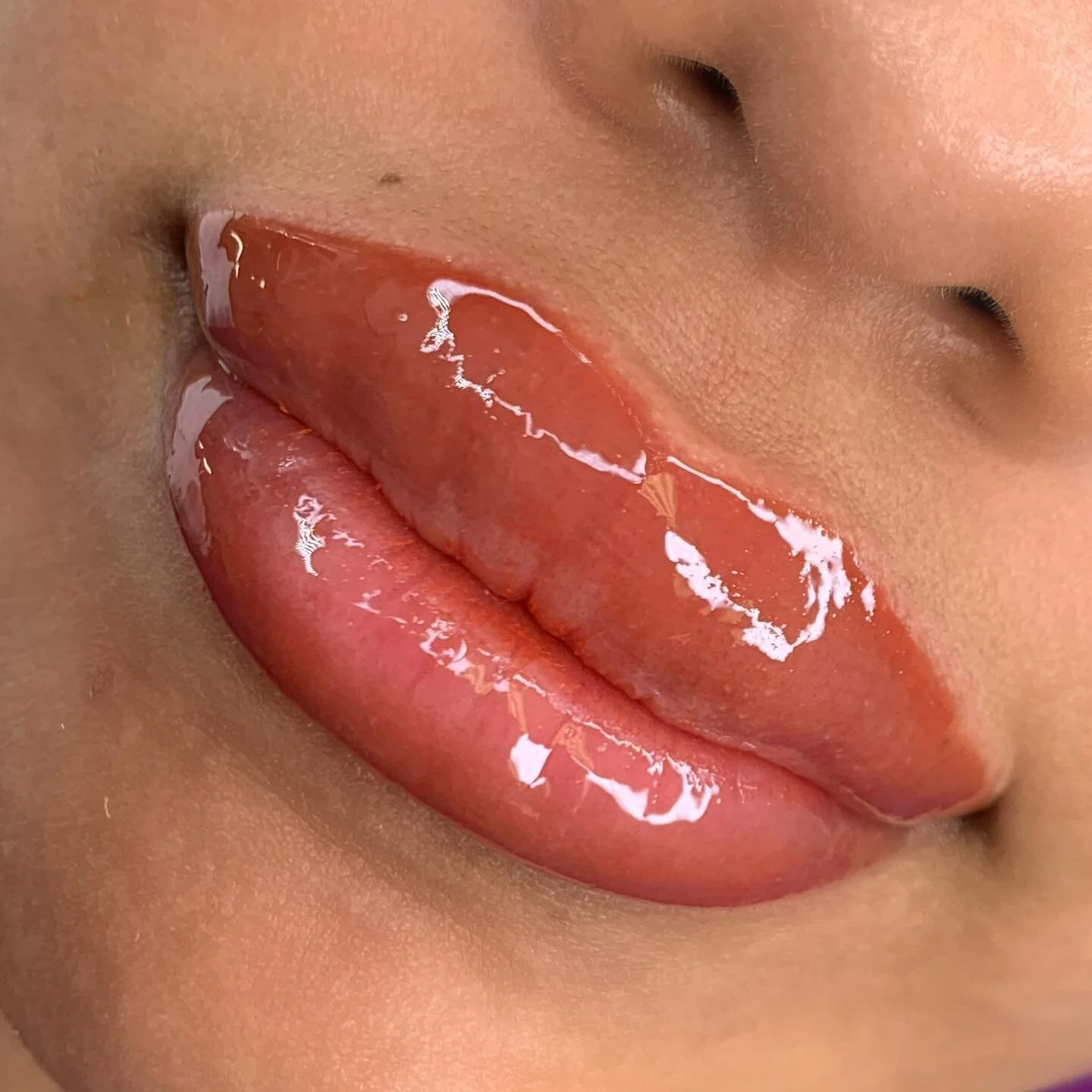 Swipe to see the right before a DARK lips correction 💋

This was our first corrective session. The level of hiperpigmentation on her her lips is pretty intense, which means we might have to do a 2nd correction on her. 

Her goal is a subtle natural 