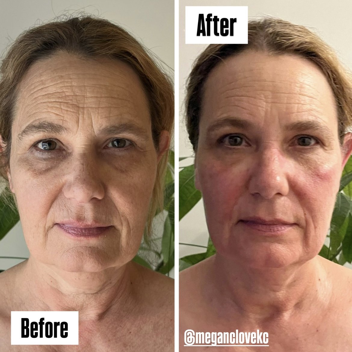 Side-by-side comparison of a woman's face before and after a skincare treatment. The left side labeled "Before" shows her with prominent wrinkles, dark circles under her eyes, and uneven skin tone. The right side labeled "After" shows her with smoother skin, reduced wrinkles, and a more even complexion.