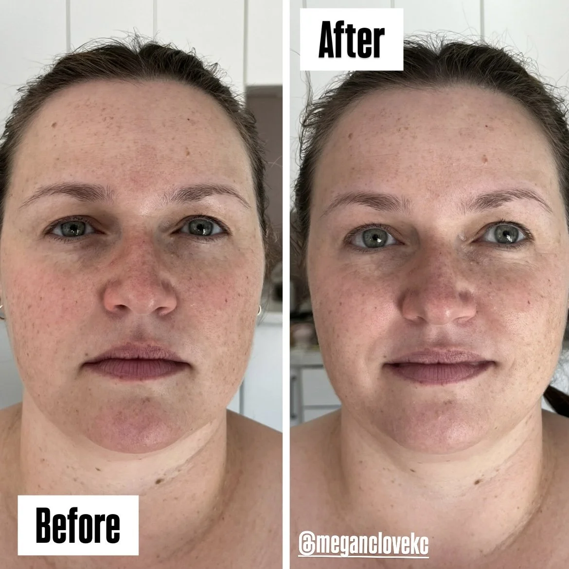 Side-by-side comparison of a woman's face before and after skincare treatment, showing improvements in skin texture and tone.