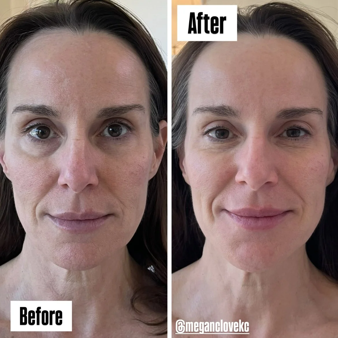 Side-by-side comparison of a woman's face before and after using skincare, showing clearer and more even-toned skin in the after photo.