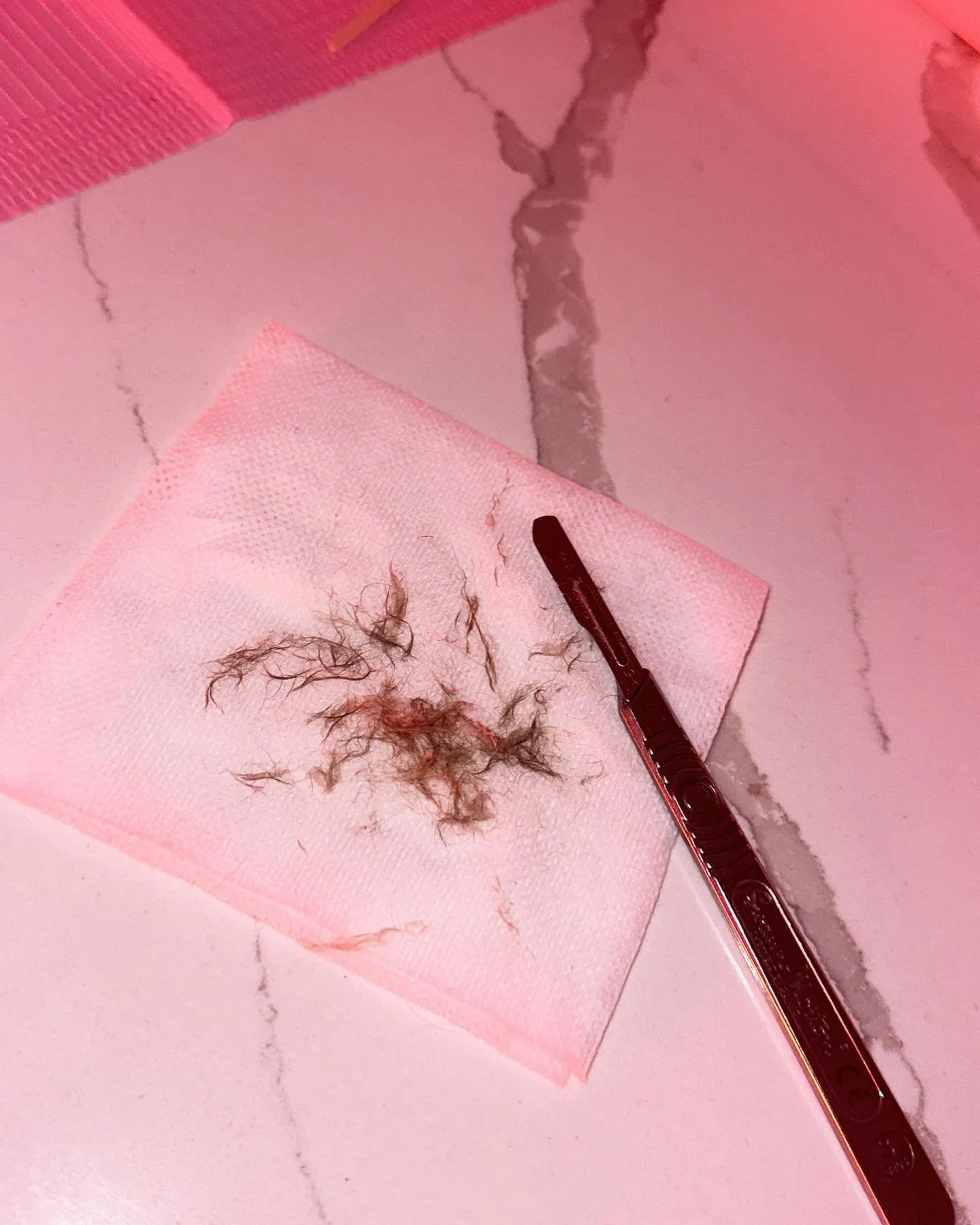 Not every client is a candidate for dermaplane. Some may never be, and many will need to wait until the health of their skin is in its best condition to do so. Sometimes we can bring it in after few treatments with a proper skin routine set into plac