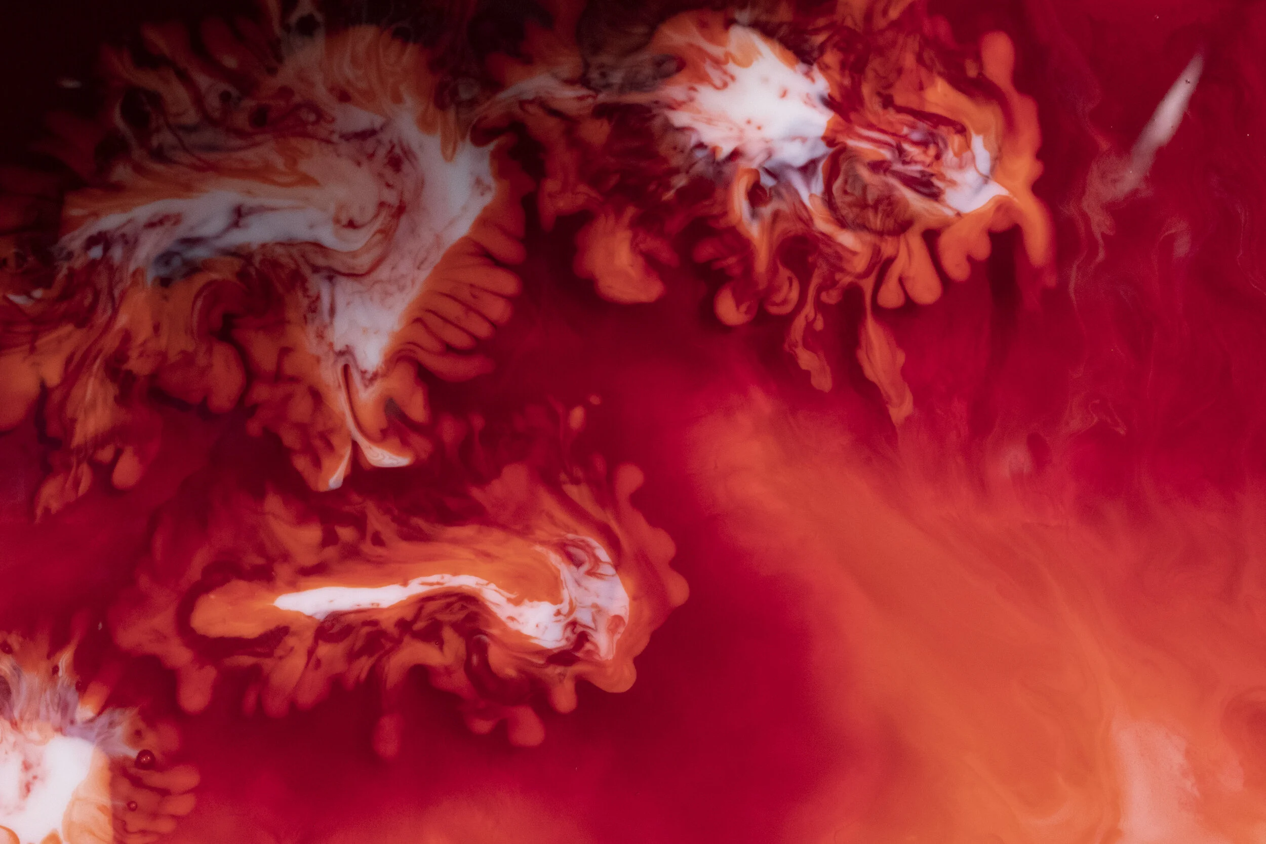 What Is Your Sickle Cell Disease Management Plan?