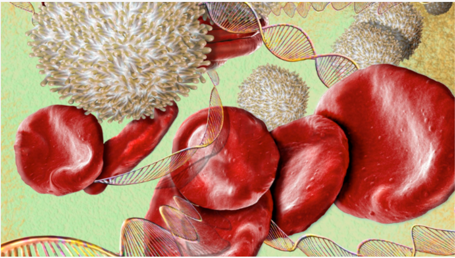 Sickle Cell: A Disease of Healthcare Disparities