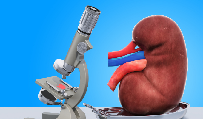 What Conditions Are Associated With Renal Medullary Carcinoma?