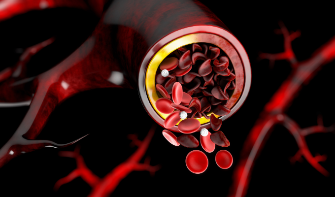 Sickle Cell and Renal Medullary Carcinoma, What Is the Relationship?