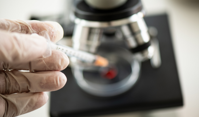 What Lab Tests Are Associated With Kidney Function?