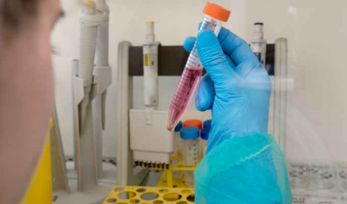 What Role Does Screening Play in Kidney Cancer Prevention?