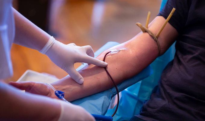 What Preparation Is Needed for a Complete Blood Count (CBC) Test?