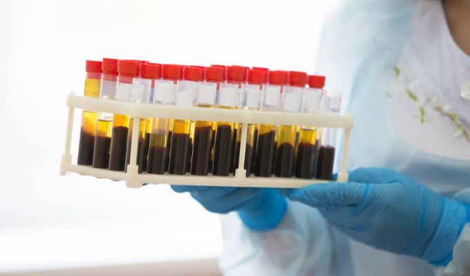 Why Is a Basic Metabolic Panel Important?