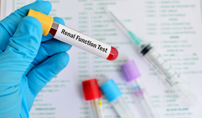 What Is an Estimated Glomerular Filtration Rate?