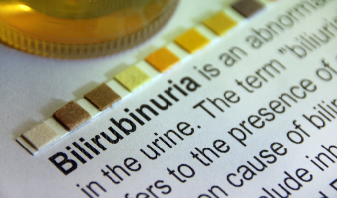 What Can Elevated Levels of Bilirubin Indicate?