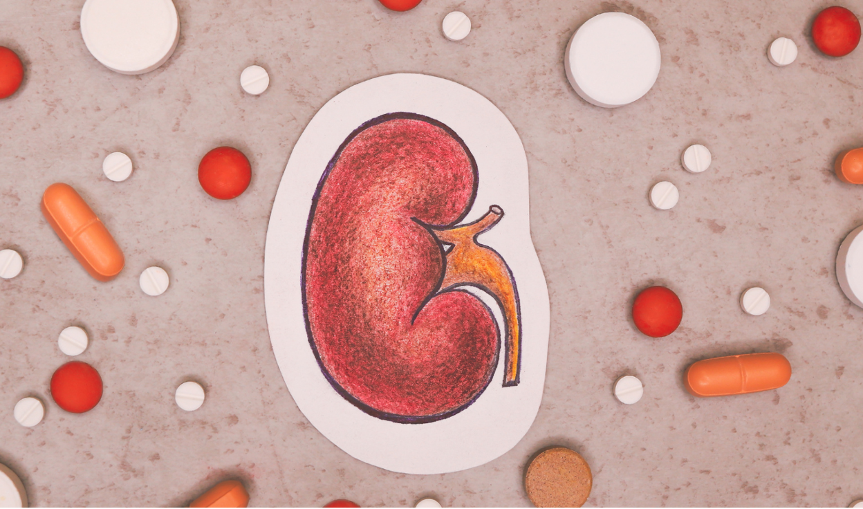 How Do Sickle Cell Disease and APOL1 Impact FSGS?