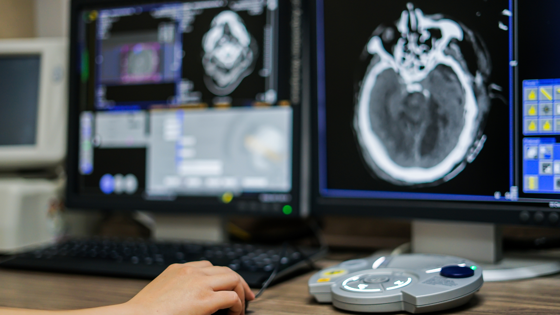 Imaging Disparities in Radiology