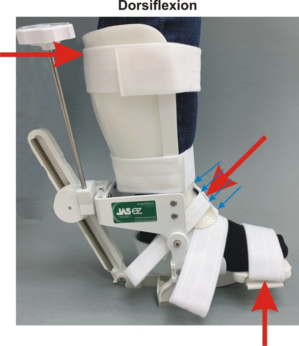 A New Saddle Pad for the JAS Ankle — Joint Active Systems