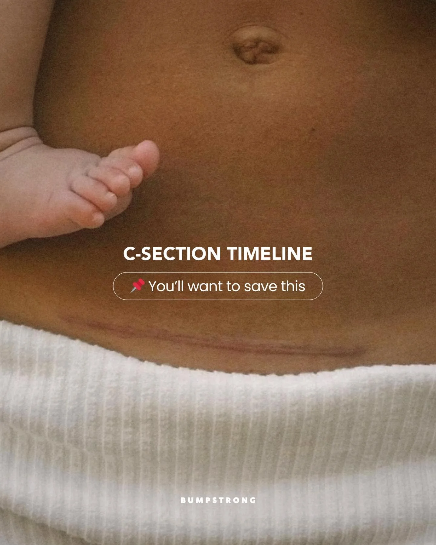 Wild that you can leave hospital after knee reconstruction with a full rehab plan&hellip;
but after a C-section - a major abdominal surgery - you&rsquo;re told VERY little!

If you&rsquo;re new to scar desensitisation or mobilisation, this matters mo