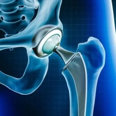 Essential Guide to Hip Replacement Rehabilitation: Prehab, Recovery Phases, and Long-Term Success