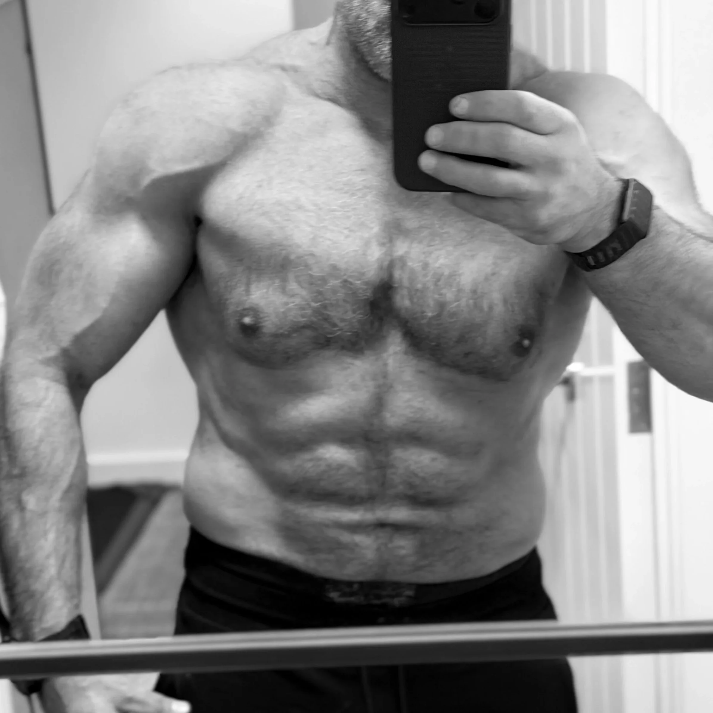 Essential Guide to Testosterone Replacement Therapy (TRT) Dosing