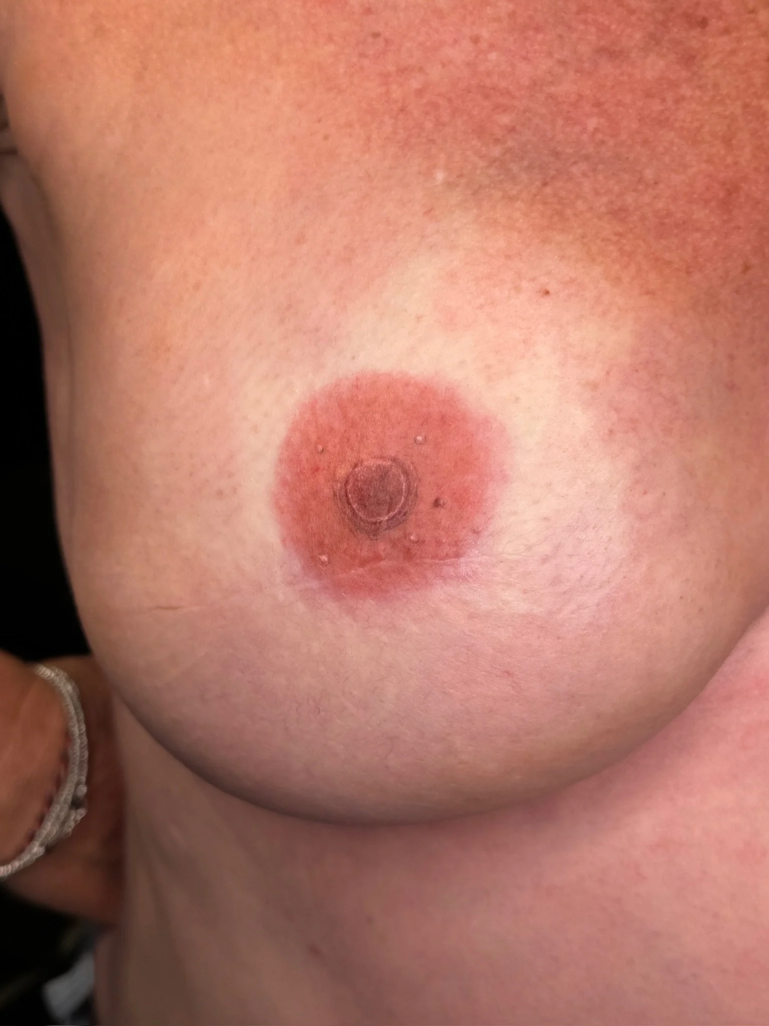 Close-up image of a person's bare chest showing a nipple with an attached piercings.