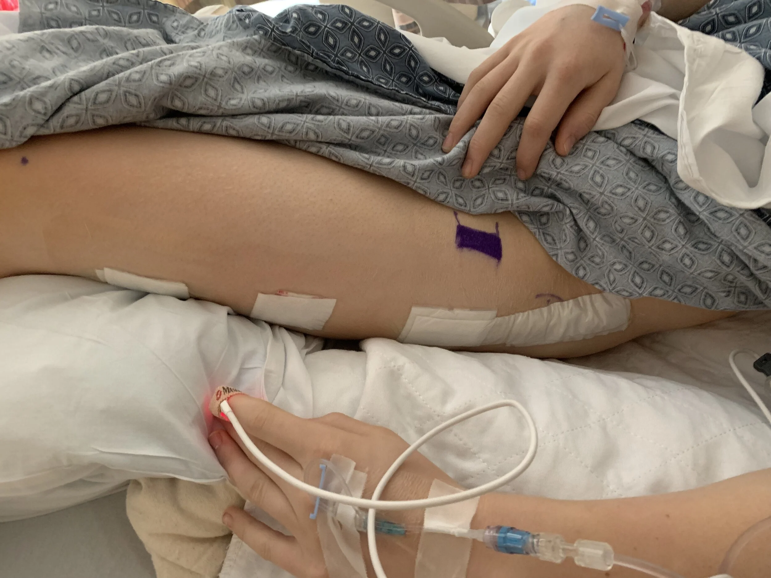 The bandaging around my incisions. 
