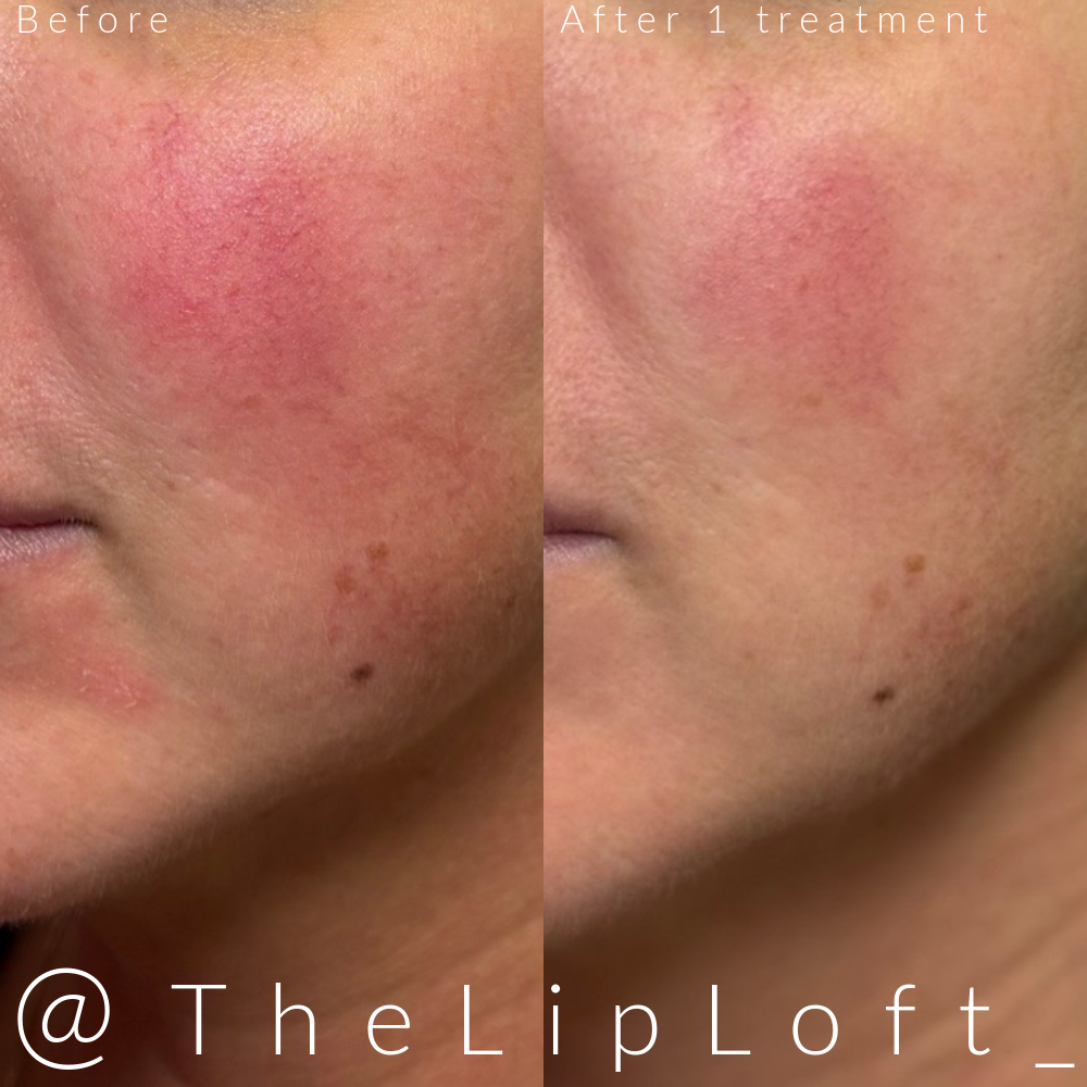 Collage maker project.PNG