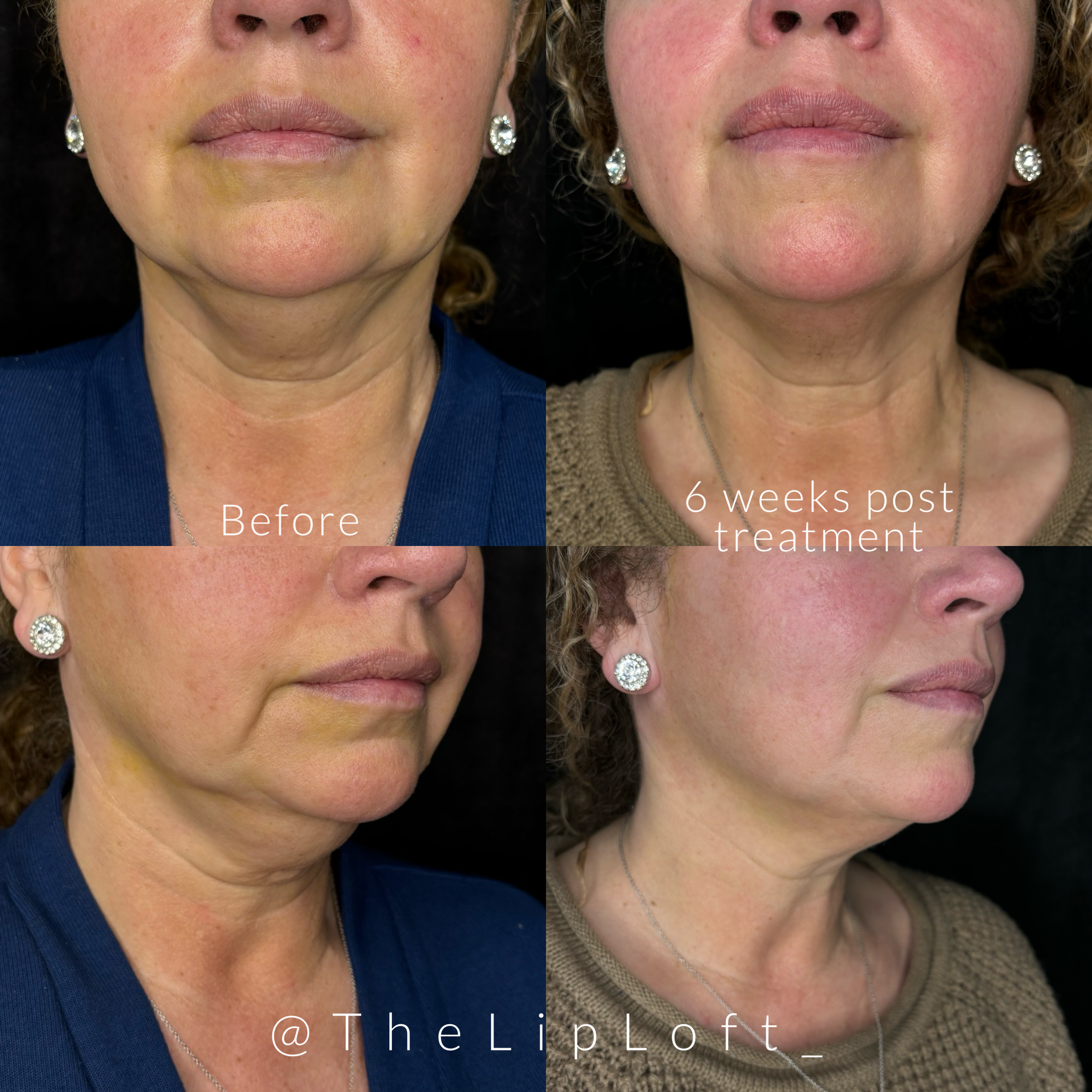 C65F6628-8414-4E08-8F4C-26AFF6FB04EE 2.PNG