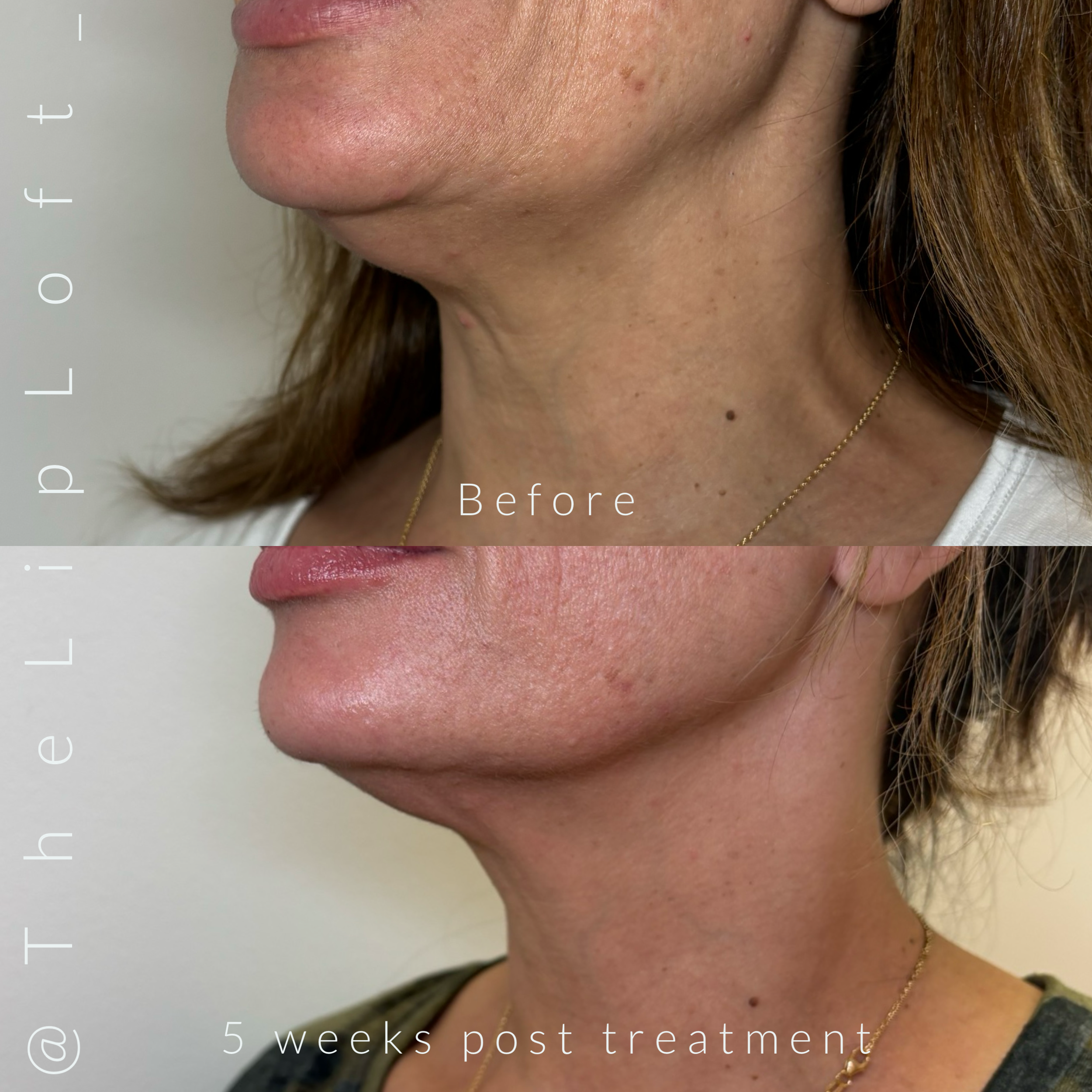 E1AB91C3-8112-45B7-BCC9-64FE022F77B4 2.PNG