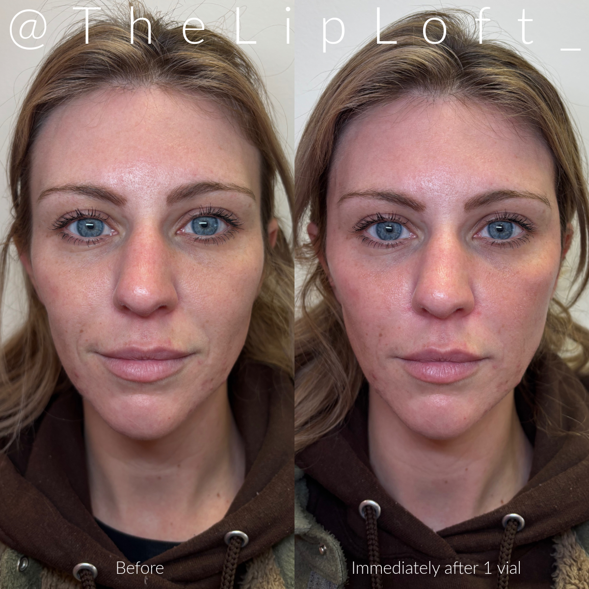 My project copy copy copy copy-2 2.PNG