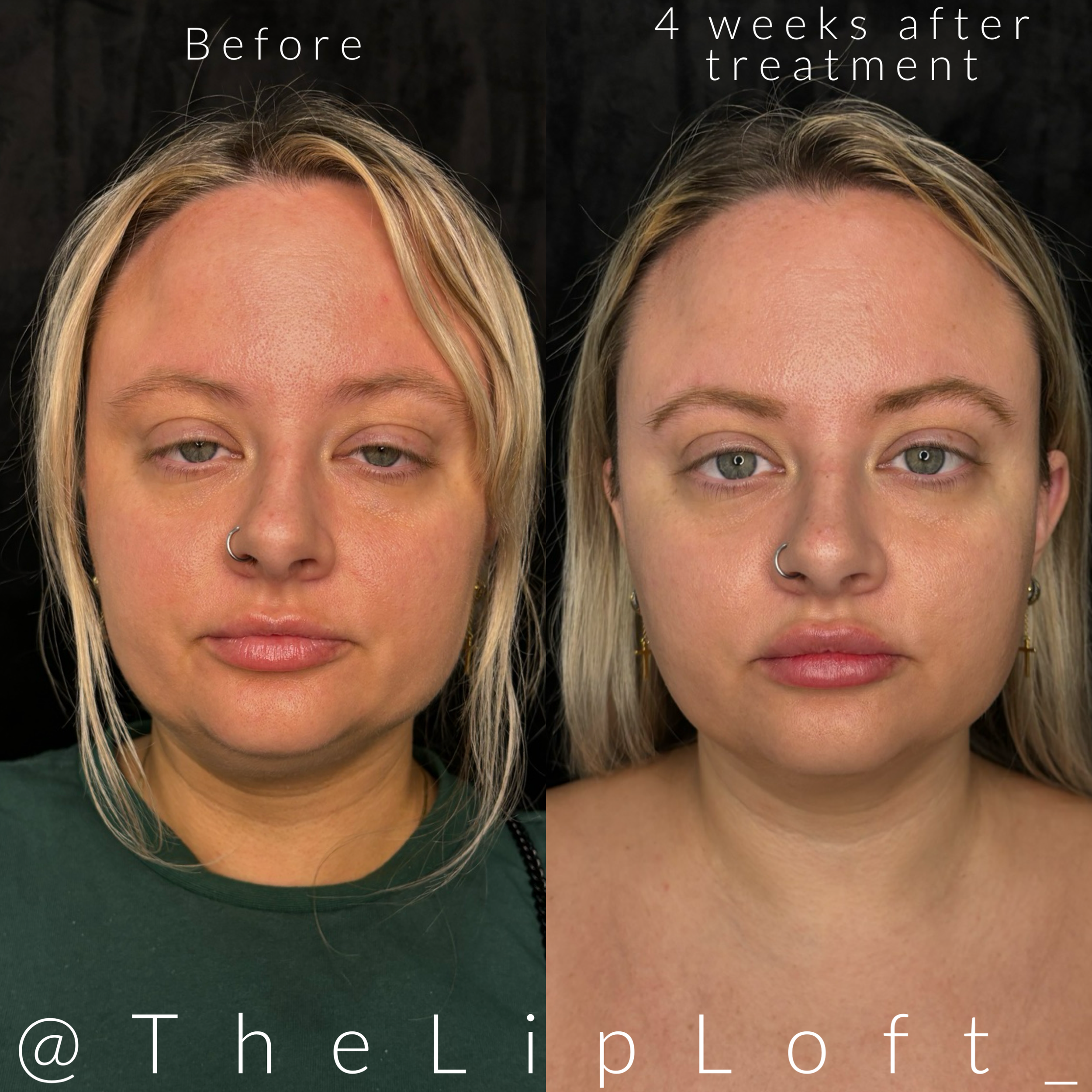 AE1F0034-3B0F-47E3-B30A-AFB433DFEB1C 2.PNG