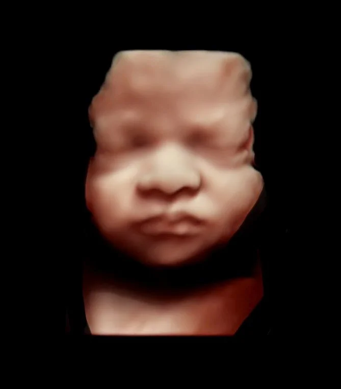 Gallery 3 — Matherly Ultrasound Imaging