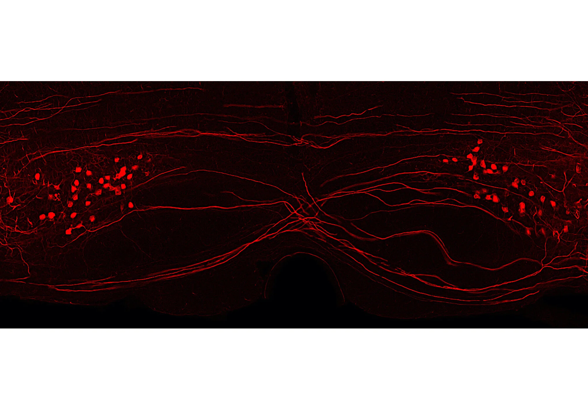 Crh+ neurons in mouse brainstem_Image 3 gallery_7-19-2020.jpg