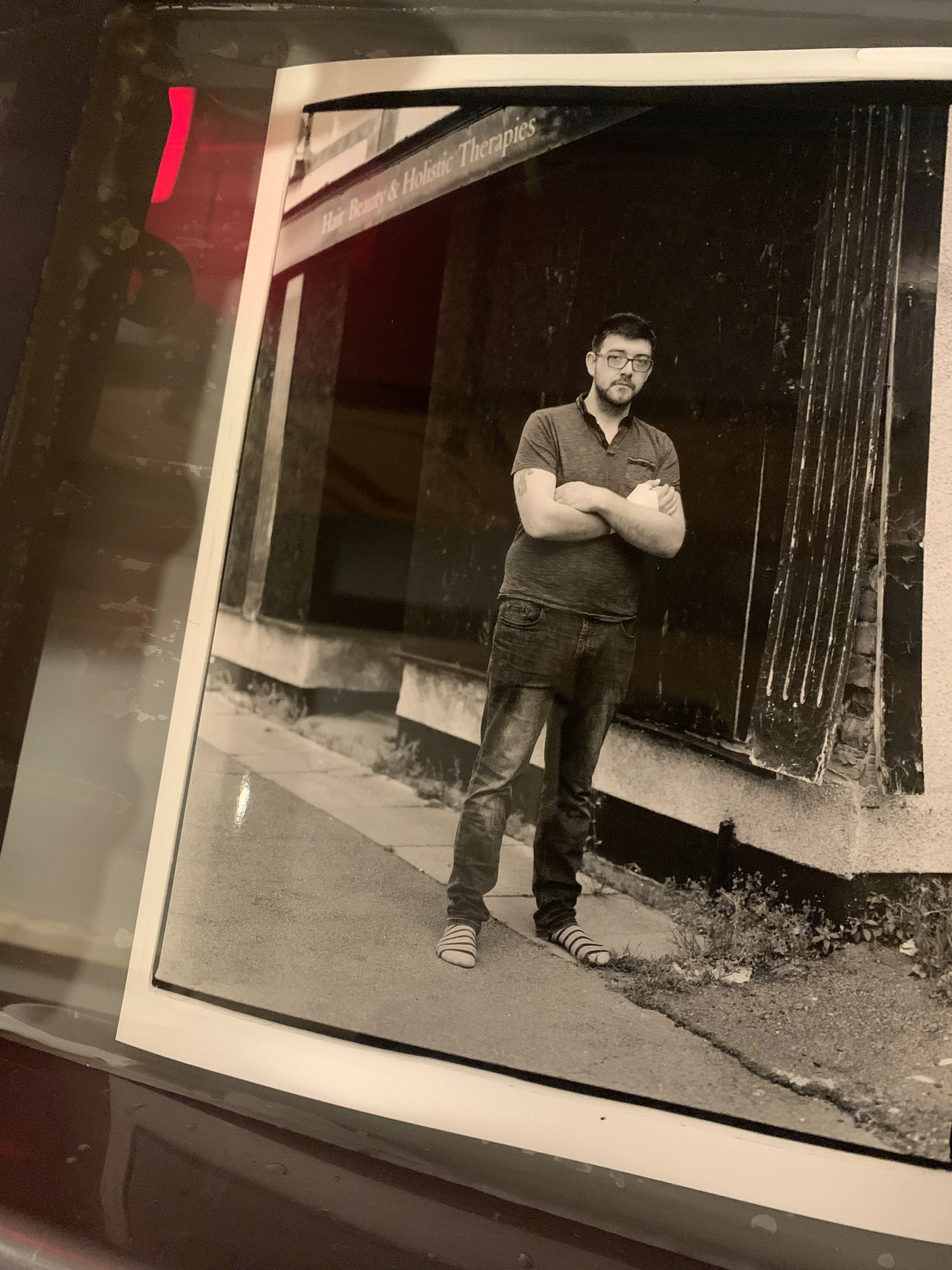 Ryan with Broken Hand