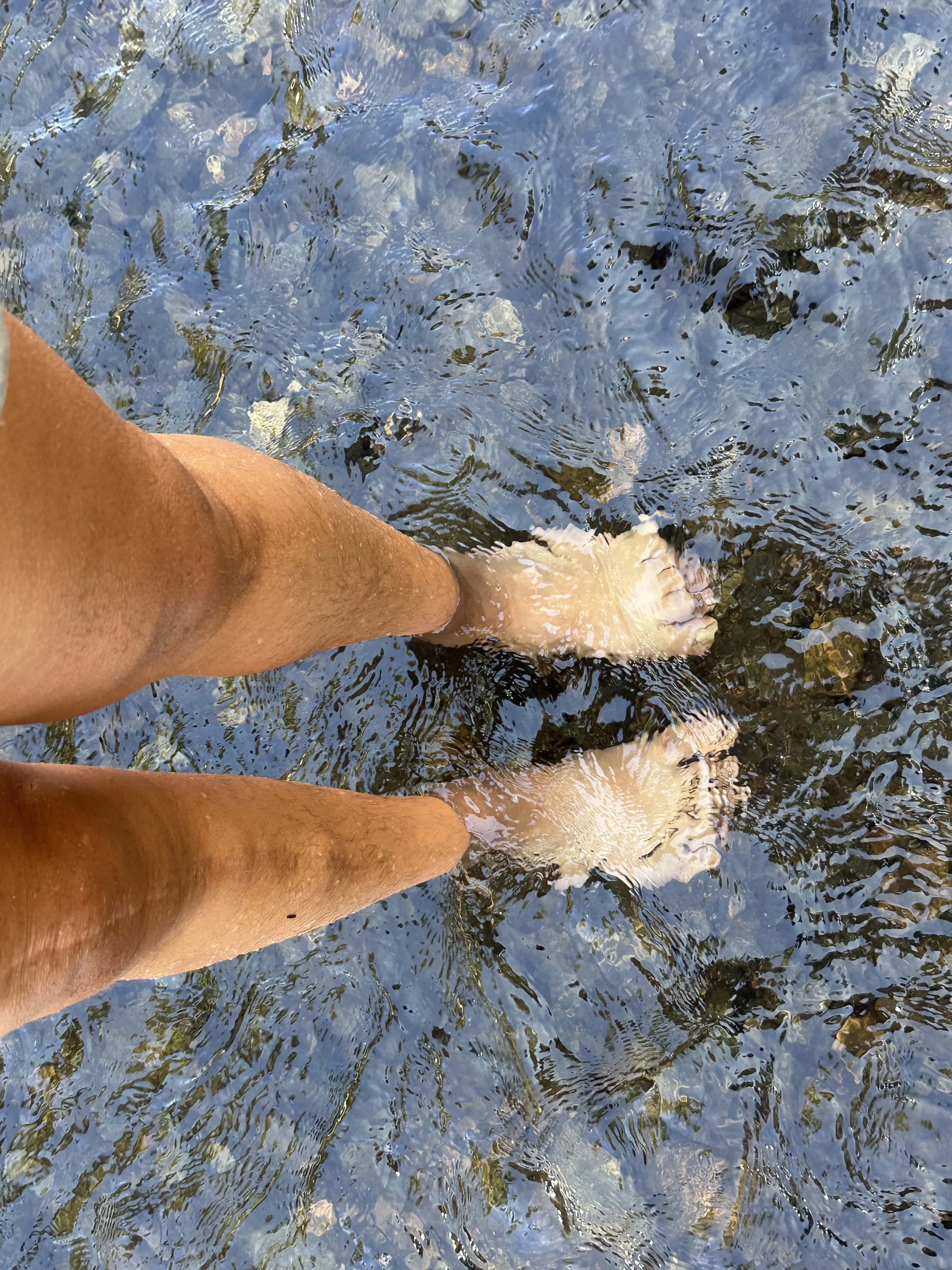 Looking down at 2 legs standing on lake shore rocks. The right leg has a long scar.