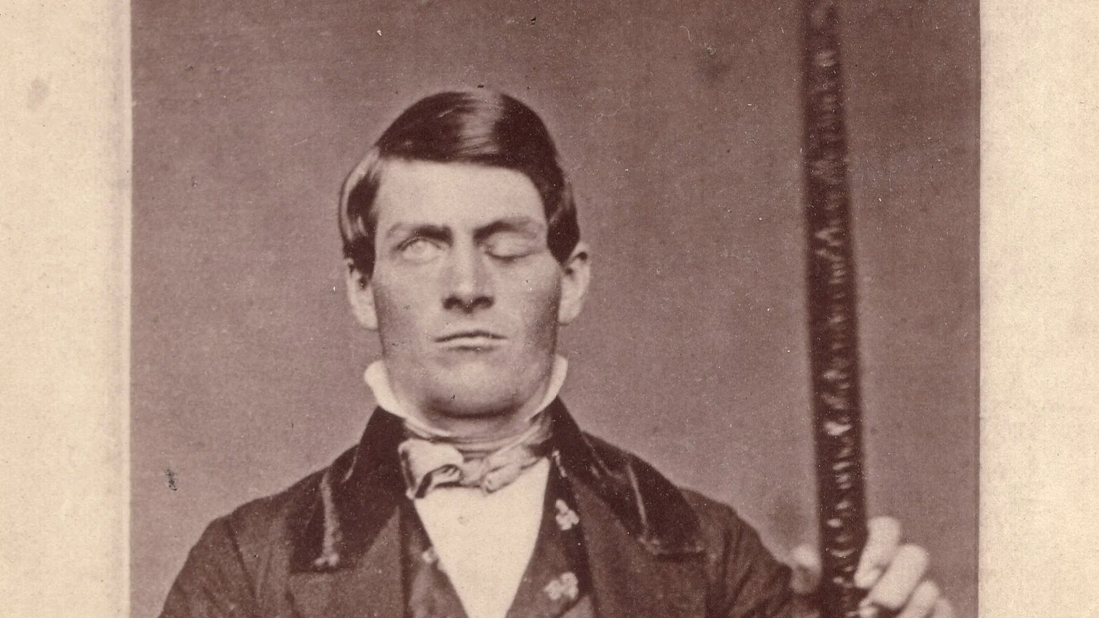 The Disappearing Man: Body, Soul, and the Question of Who We Are