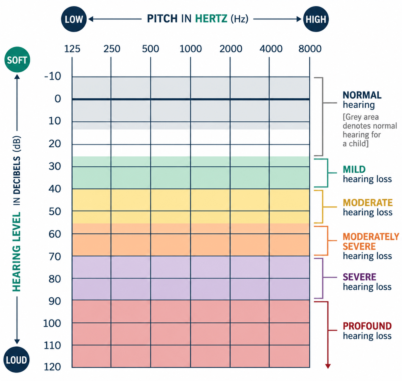 Audiogram showing pitch and hearing level scales, with colour-coded ranges from normal hearing to mild, moderate, moderately severe, severe and profound hearing loss.