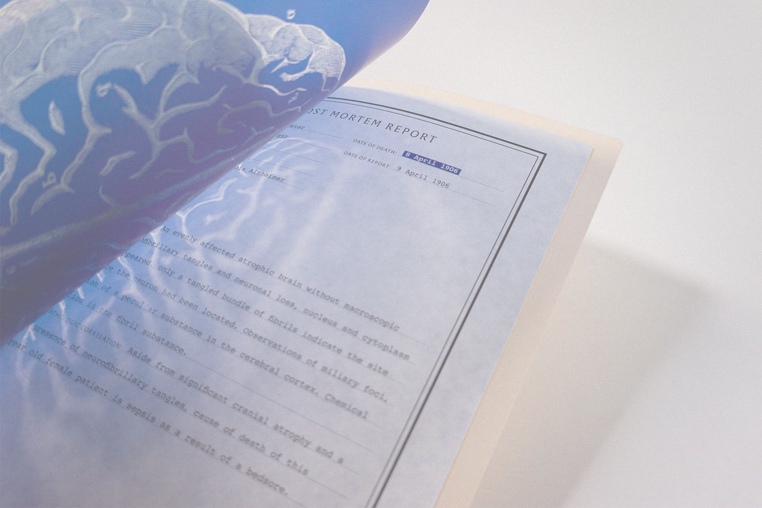 Alzheimer's Case no. 1