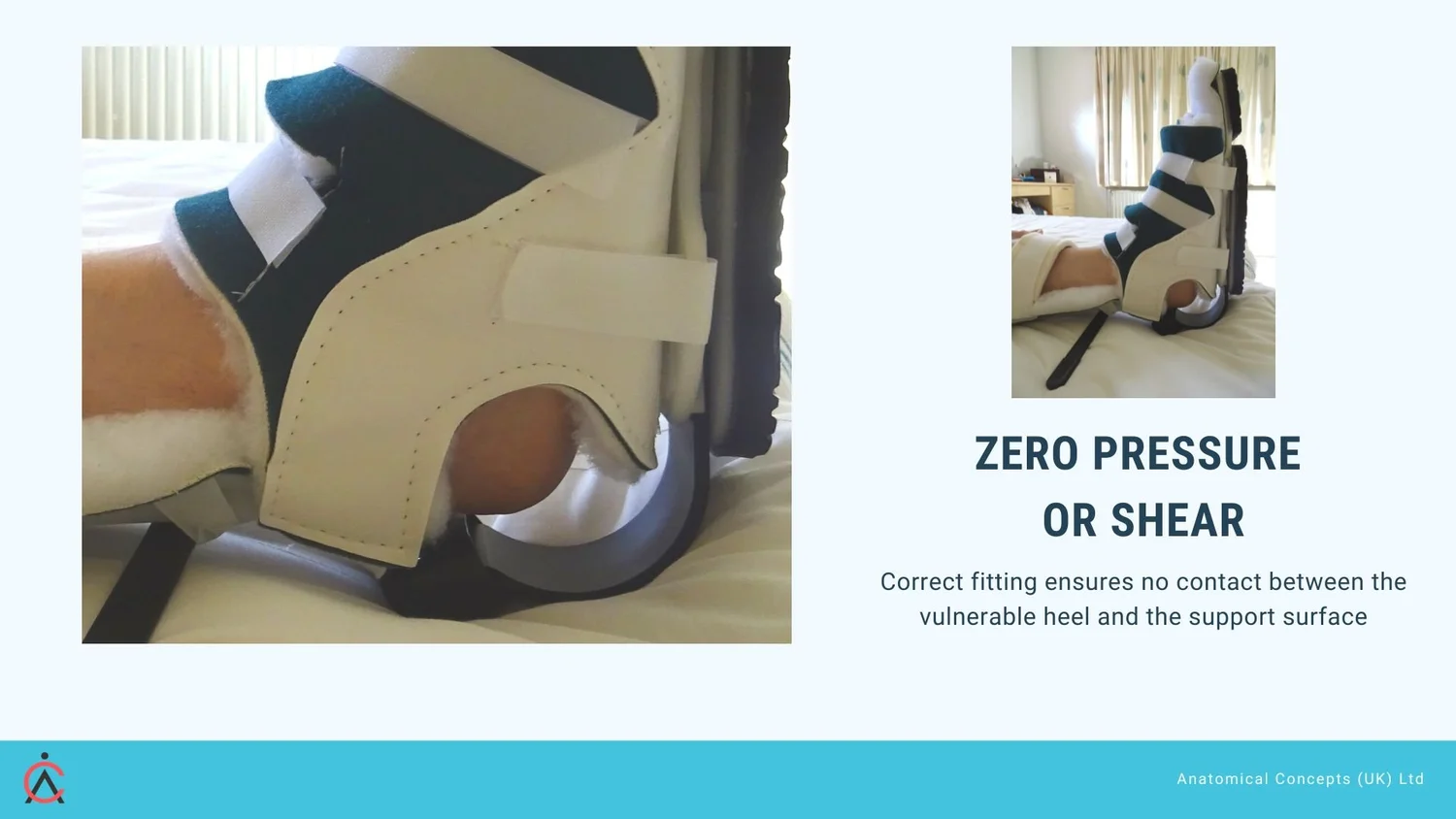 Prafo Inflatable Floating Heels: What the 2025 International Pressure Injury Guideline ...