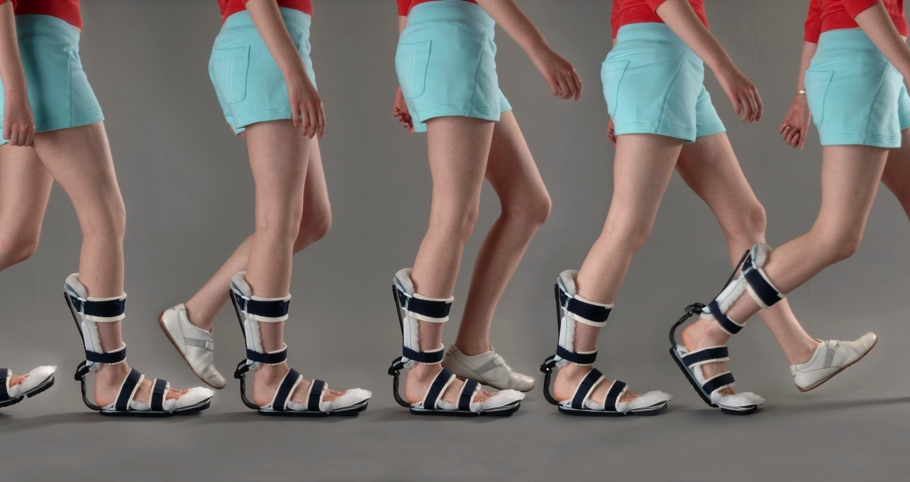 Prafo Inflatable PRAFO Guide — Anatomical Concepts