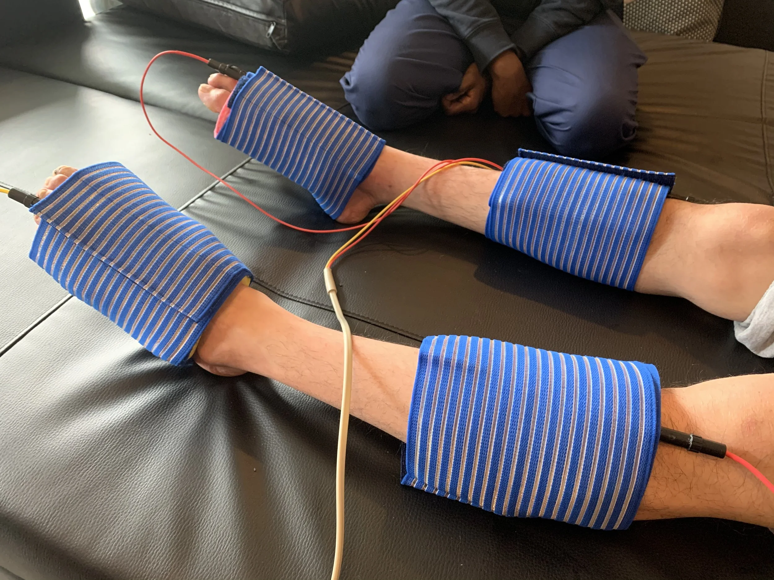 Normal vs Denervated Muscle: Why the Rules of Electrical Stimulation Change After Nerve Injury
