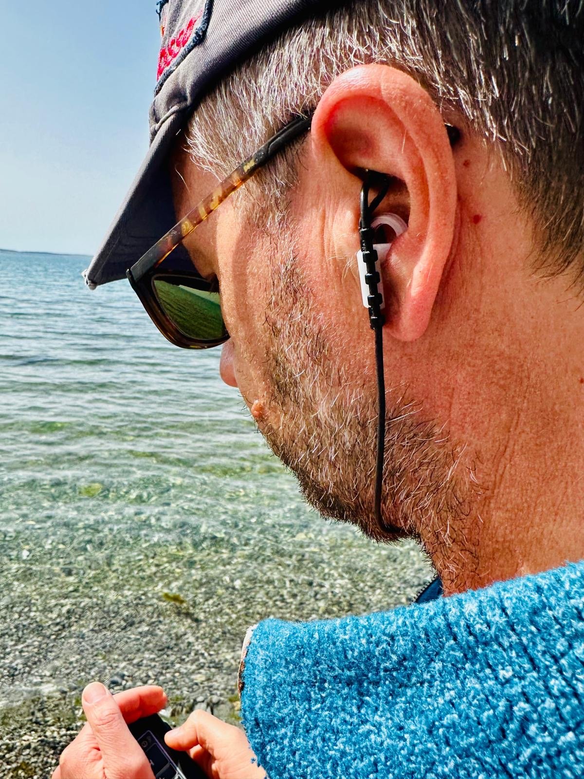 Is Ear Vagus Nerve Stimulation an Alternative to Epilepsy Surgery?