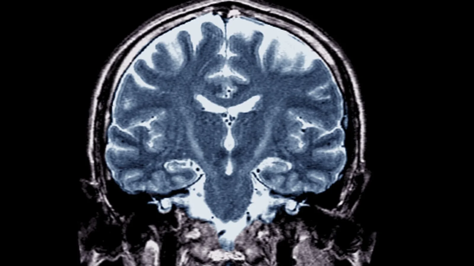 Stat News Op-Ed - I have a genetic mutation linked to ALS. The Trump administration terrifies me
