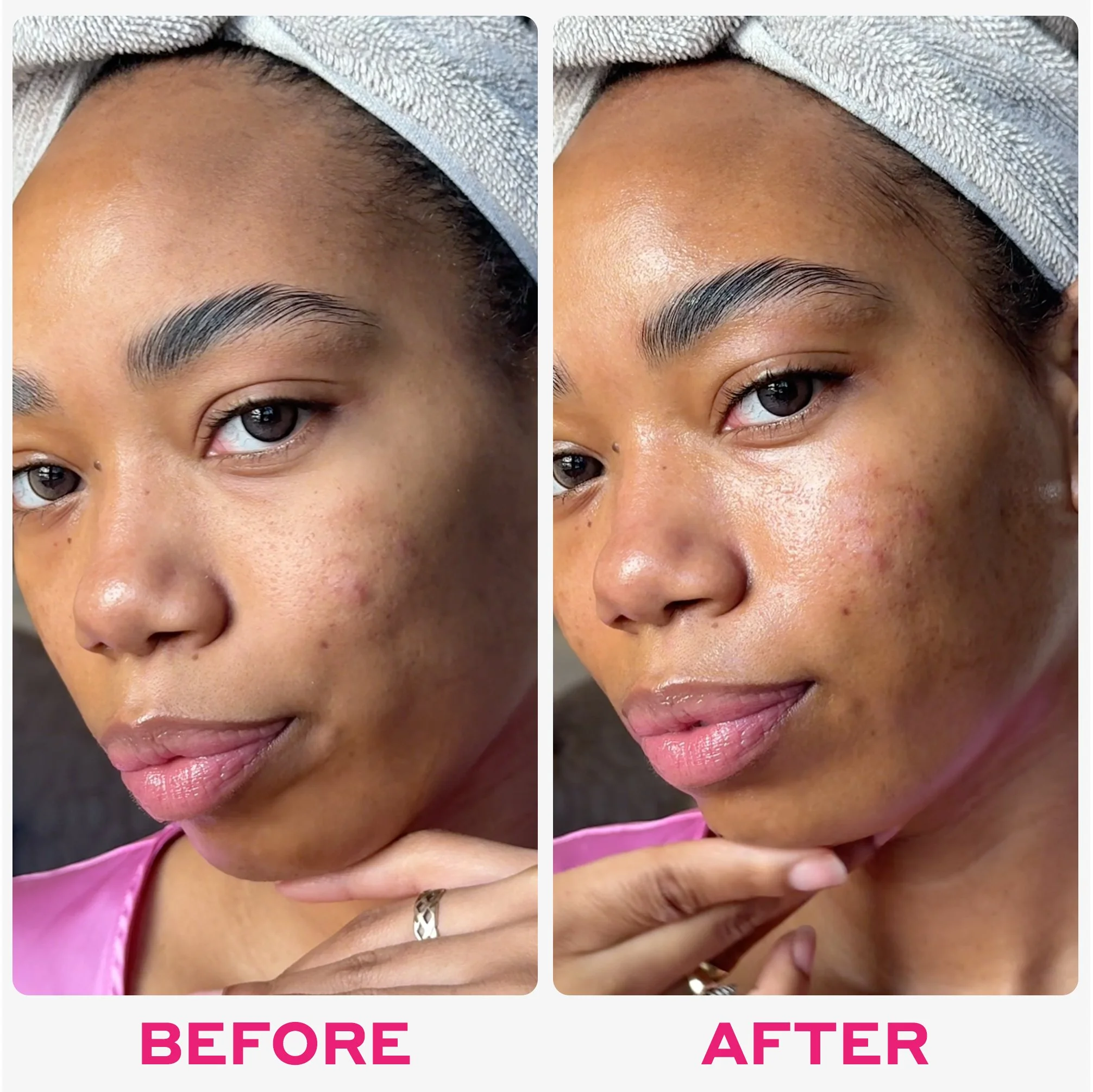 Before-and-After.jpg