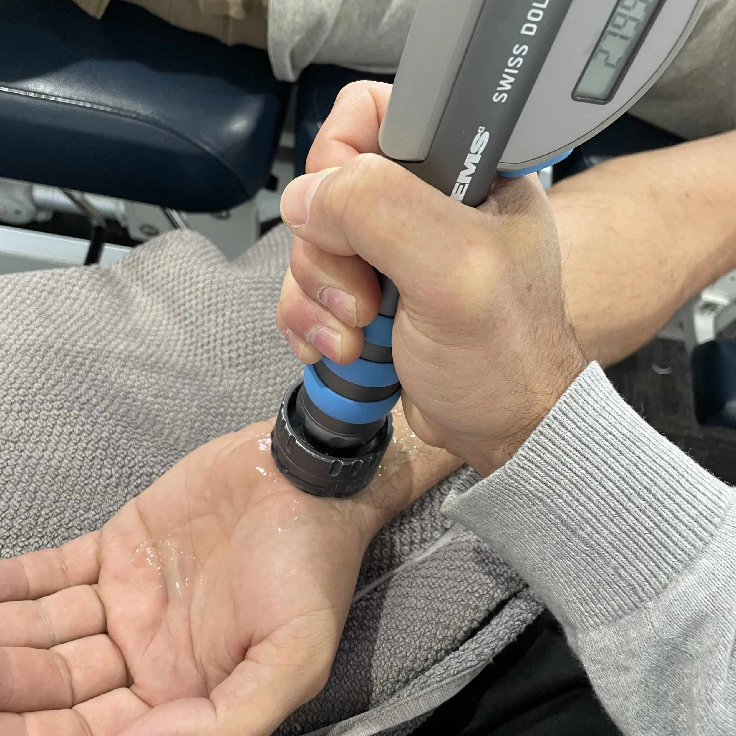 Shockwave Treatment for Carpal Tunnel Syndrome - Non-Surgical Solutions